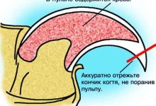 Photo of Как правильно стричь когти у кролика